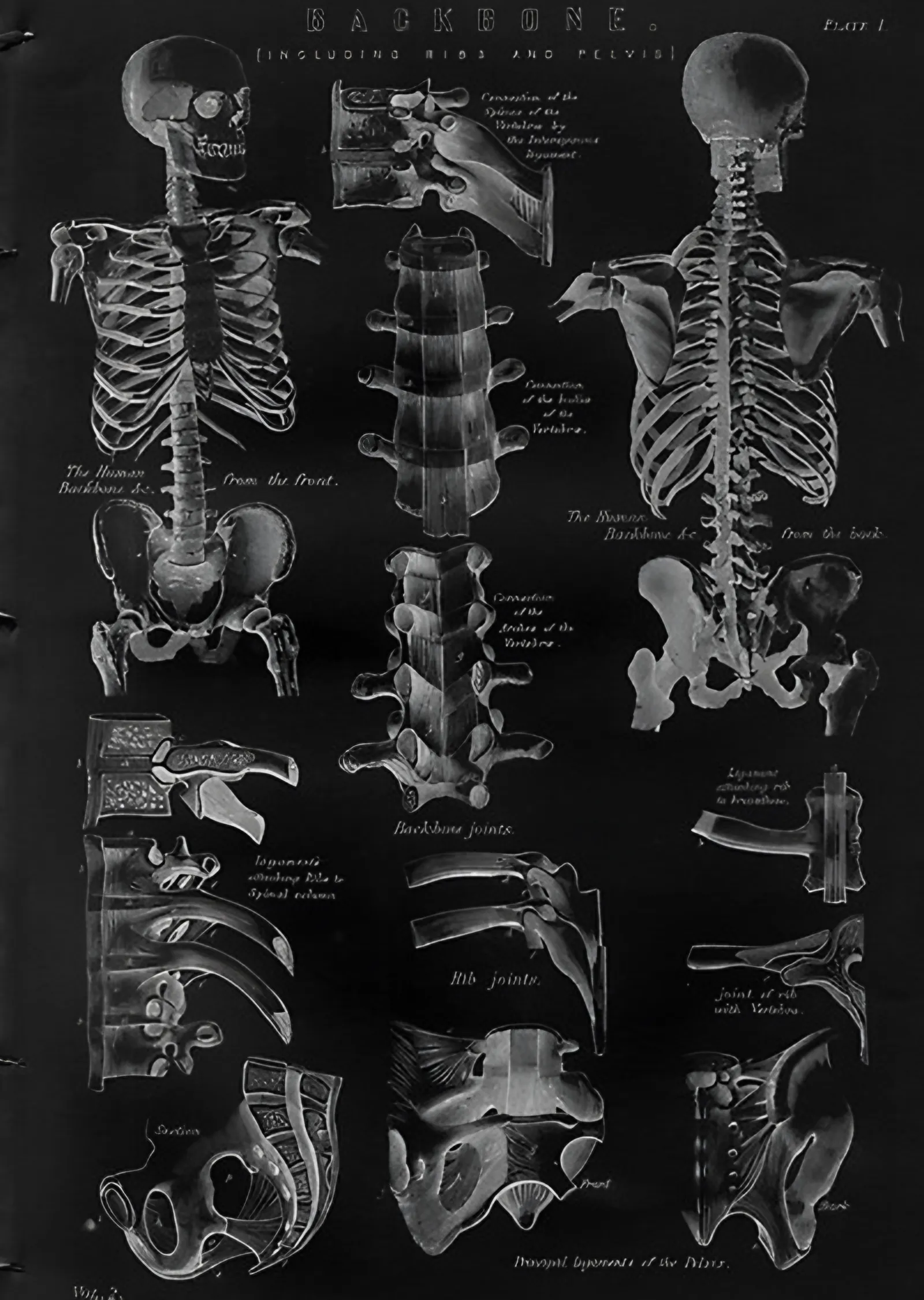 Omurga Anatomisi - Vintage Anatomi Levhası metal tablo